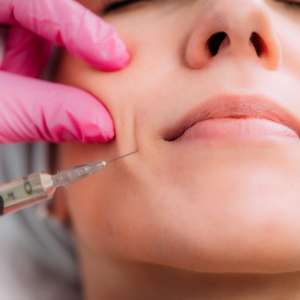 Restylane Refyne