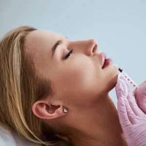 Lip filler Restylane Kysse.