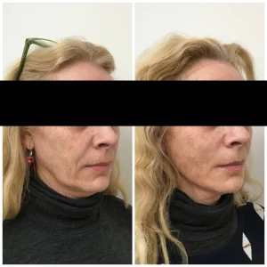 PDO Threads before and after