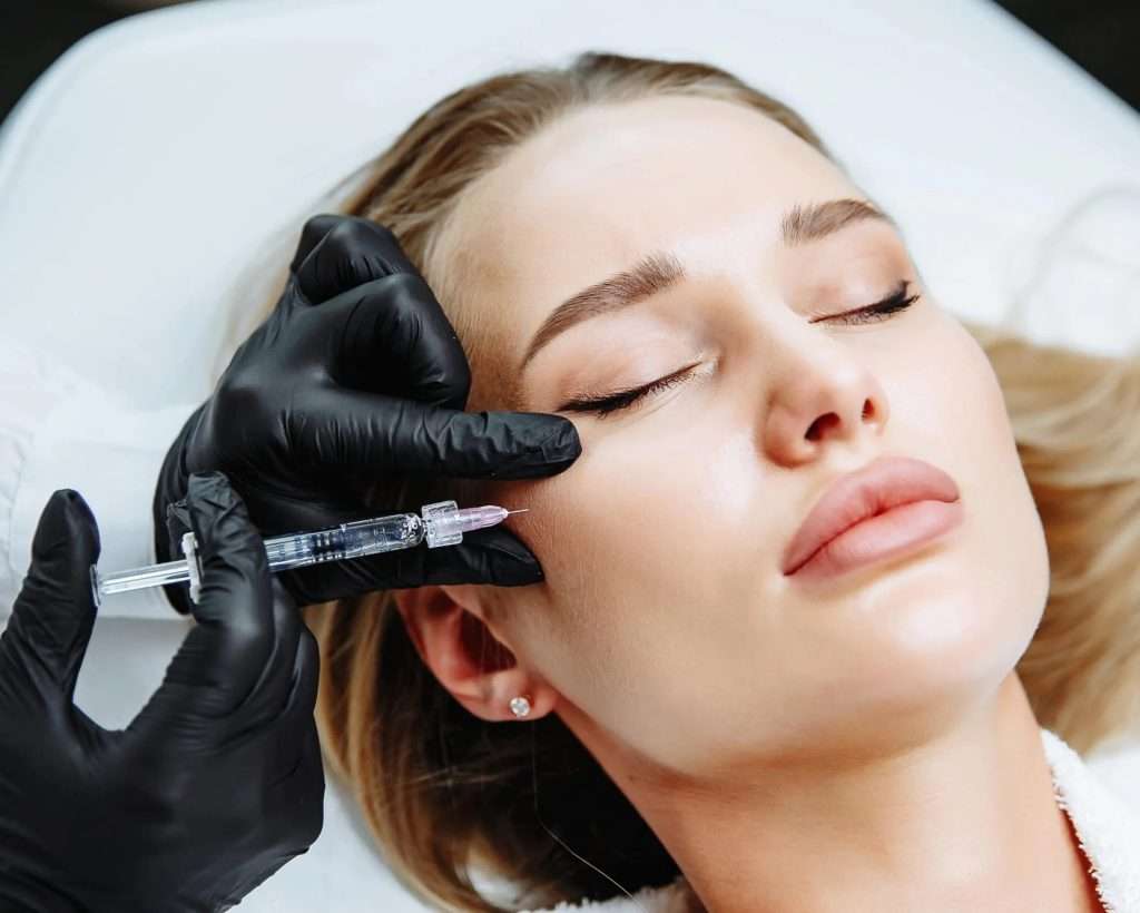 Facial filler treatment showing natural volume restoration at Allurant Medical Spa San Diego