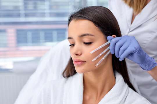 Thread lift treatment in San Diego