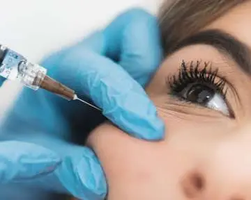PRF under eye filler treatment San Diego, Allurant Medical Spa