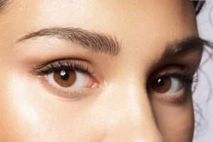 dark circle treatment San Diego patient