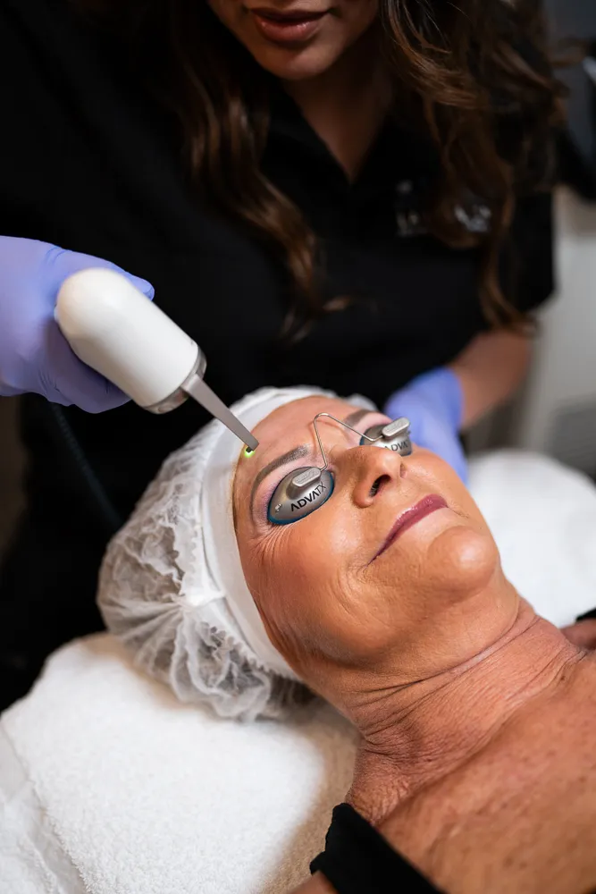 AdvaTx laser San Diego treatment for clear skin