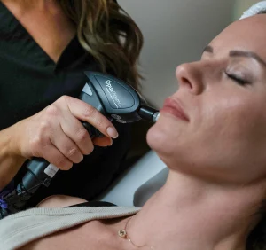 Opus laser treatment in San Diego