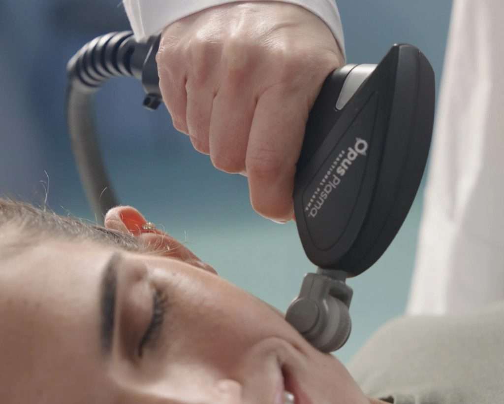 Opus Plasma treatment in San Diego