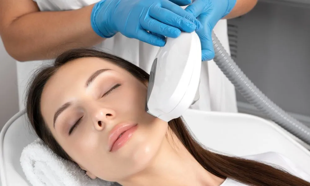 IPL photofacial San Diego treatment for sun damage
