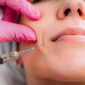 Radiesse injections, Skin firming injectable