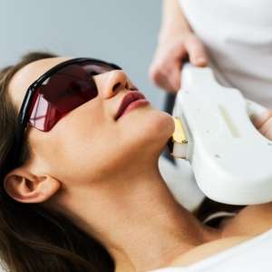 IPL Photofacial 1 Session