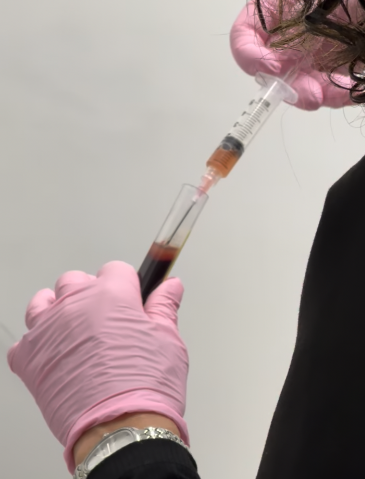 Dr Kat Khorrami O Shot San Diego procedure