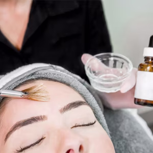 VI Peel Precision Plus