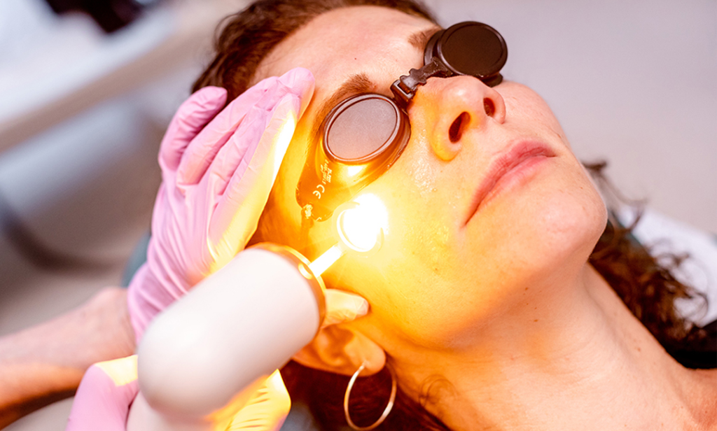 AdvaTx laser acne scars procedure San Diego clinic