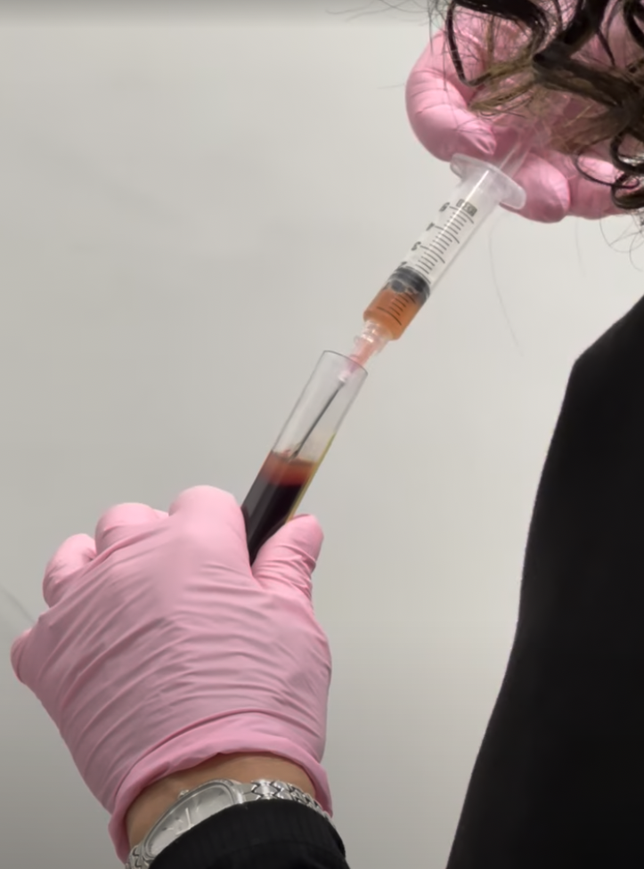 joint pain treatment in San Diego administered by Dr. Kat