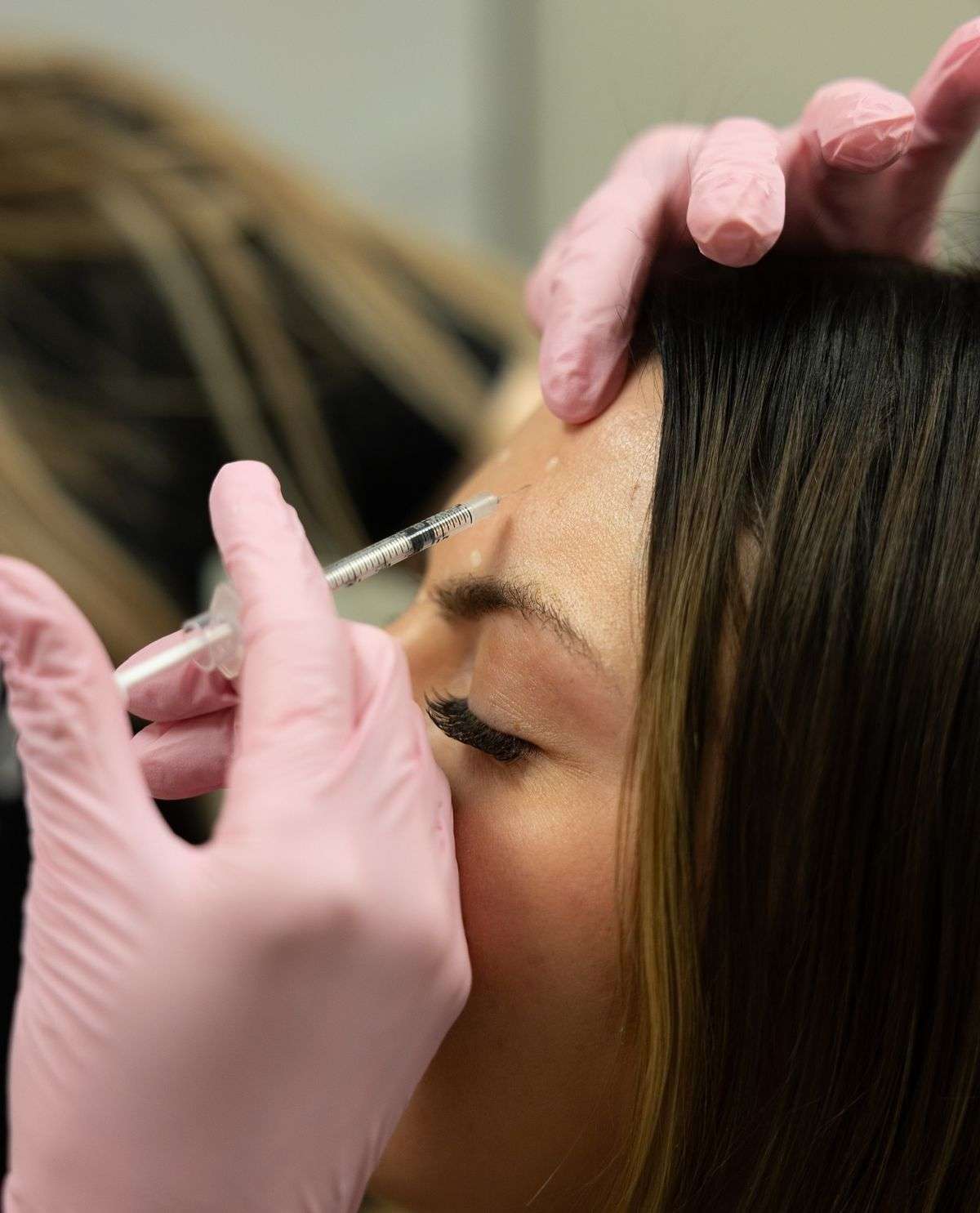 Botox treatment at Allurant Medical Spa in San Diego showing patient receiving precise facial injections