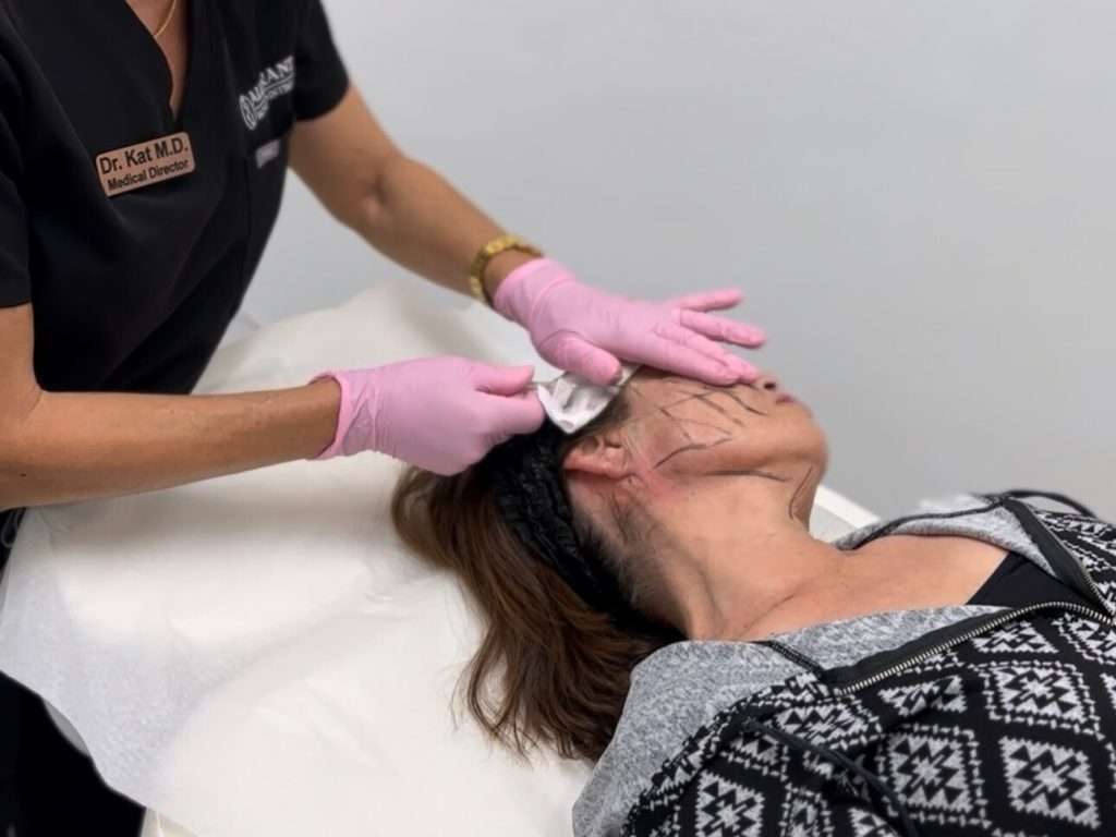 provider performing PDO thread lift treatment to lift sagging skin and improve facial contours