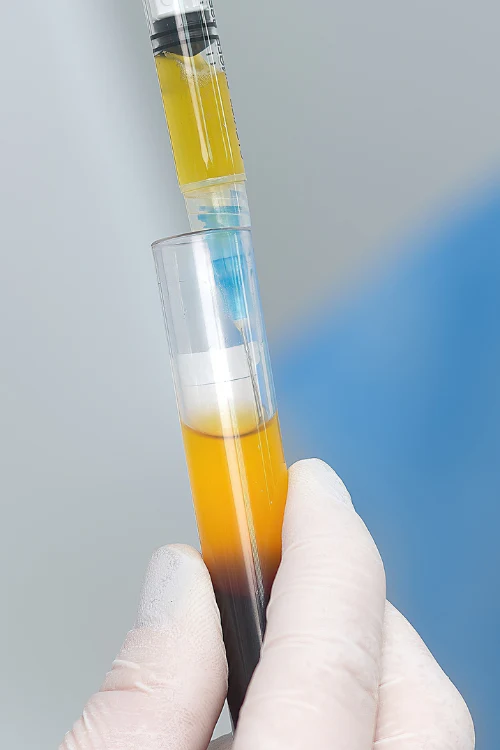 Blood processing for PRF therapy