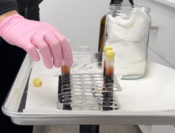 Concentrated platelet-rich plasma vial for regenerative ED treatment