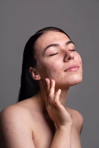 advatx laser benefits for men and women
