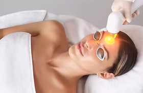 Adva Tx laser treatment being performed on patient in San Diego.