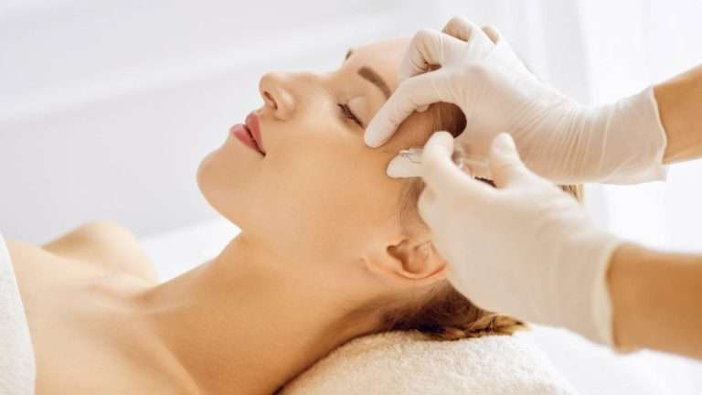 Sculptra results San Diego jawline contour improvement