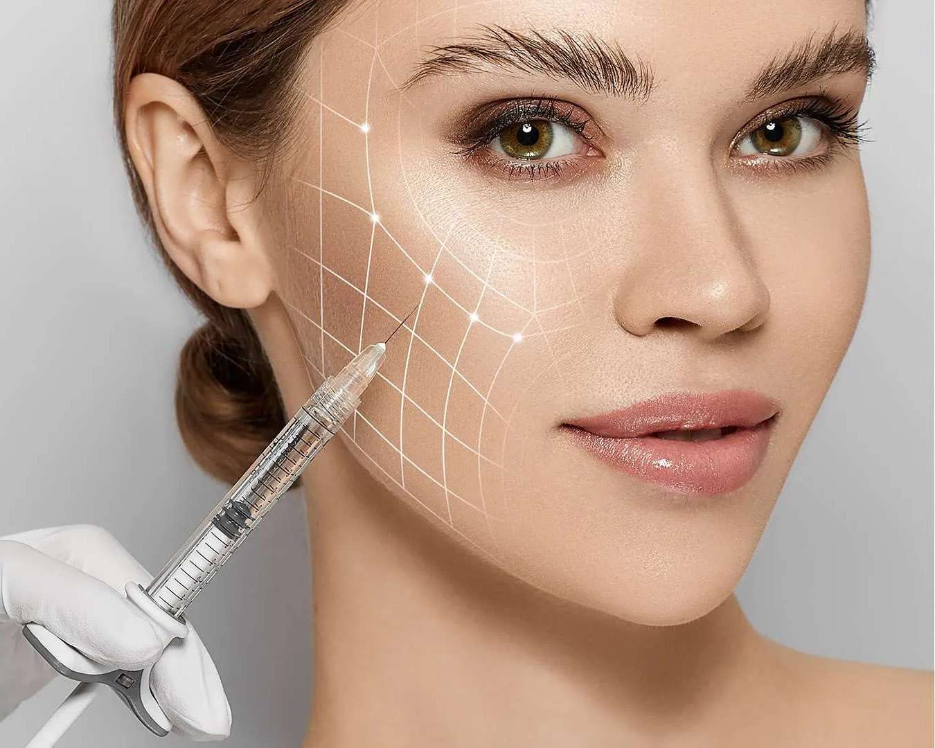 Sculptra treatment in San Diego