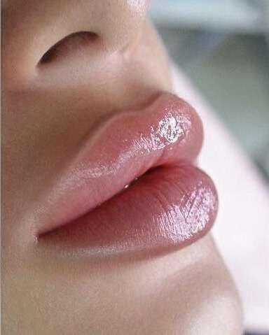 lip filler treatment in San Diego at Allurant Medical Spa natural lip augmentation results
