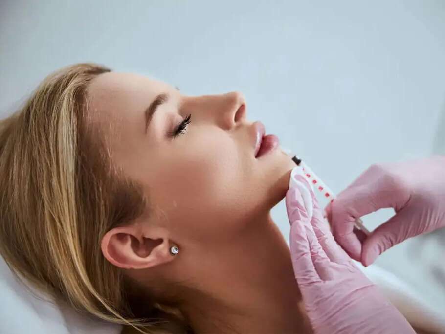 smooth hydrated lips after lip filler treatment San Diego dermal filler results