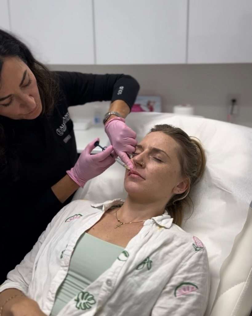 lip filler injection procedure using dermal fillers for natural lip enhancement in San Diego