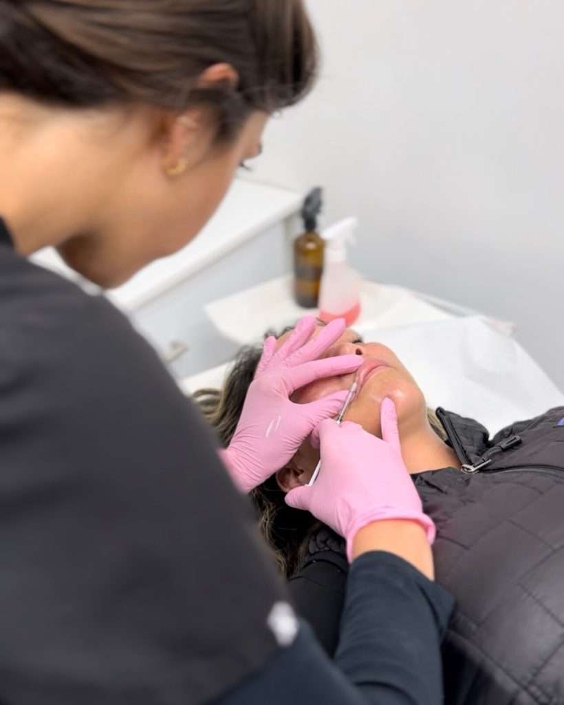 experienced lip filler injector preparing dermal filler injection treatment in San Diego