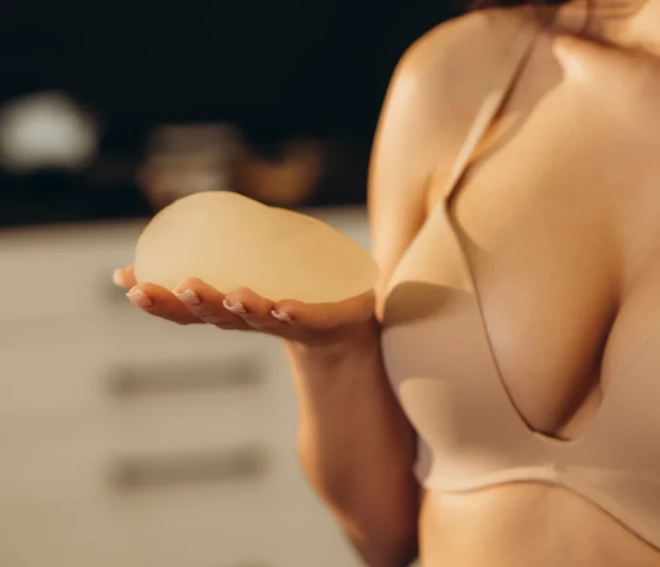 breast implant surgery showing silicone implant placement for breast augmentation