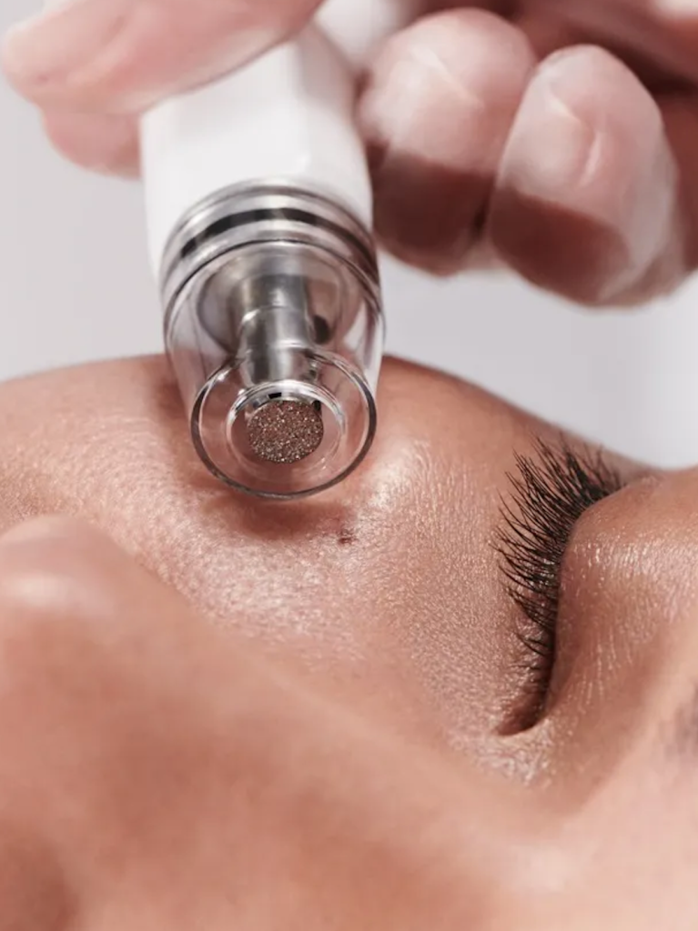 diamond glow facial treatment at Allurant Medical Spa in San Diego for glowing hydrated skin