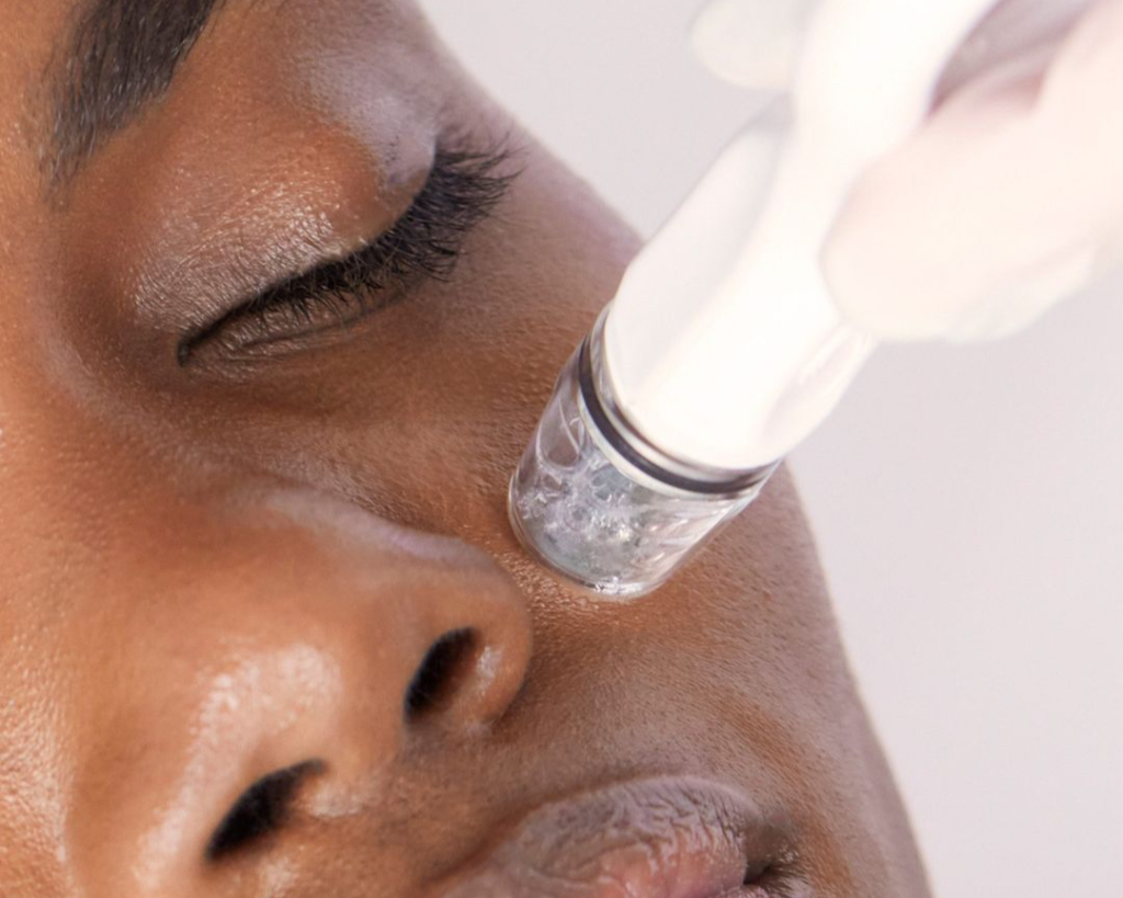 DiamondGlow facial exfoliation and serum infusion treatment at Allurant Medical Spa San Diego