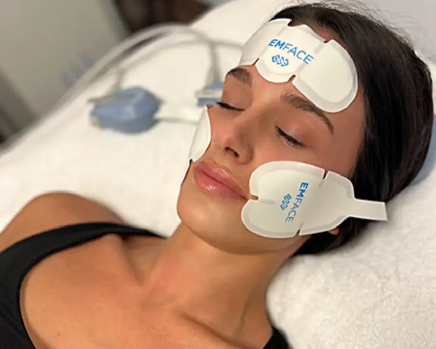 EMFACE for facial lifting in san diego