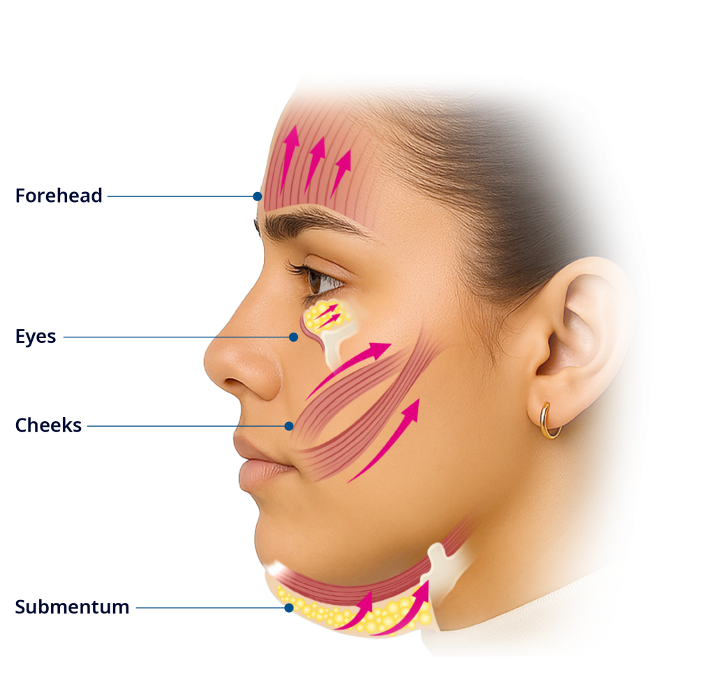facial muscle stimulation in San Diego