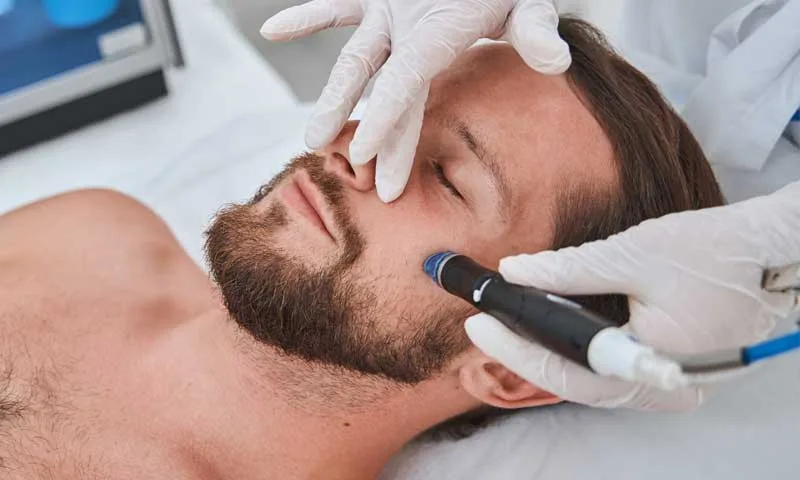 Morpheus 8 vs Scarlet RF skin rejuvenation San Diego