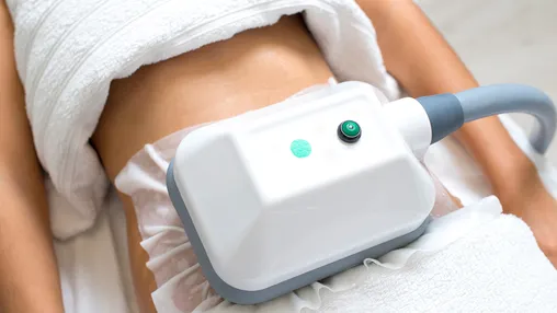 CoolSculpting fat freezing procedure