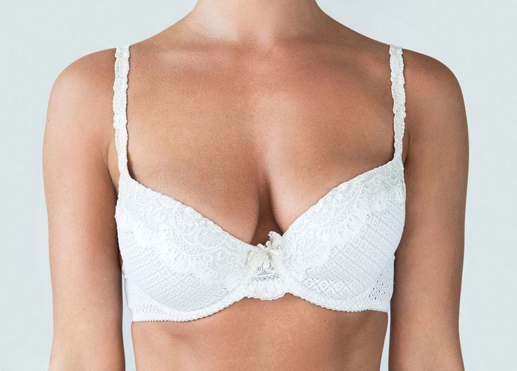 Breast lift with fat transfer results in San Diego showing natural breast enhancement and long-lasting volume