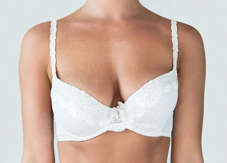 Breast lift with fat transfer results in San Diego showing natural breast enhancement and long-lasting volume