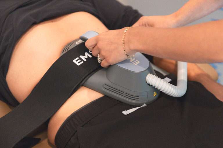 Emsculpt body contouring treatment for fat reduction in San Diego