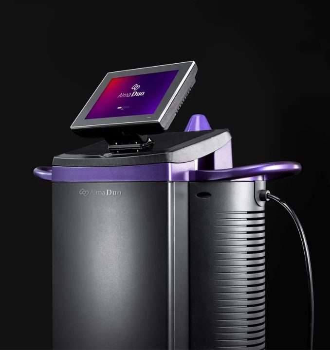 Alma Duo shockwave therapy treatment in San Diego