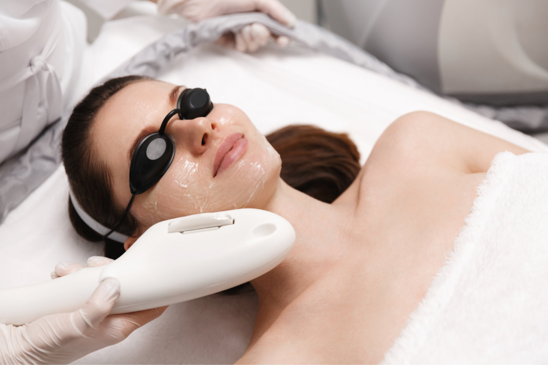 Close up of IPL photofacial treatment on patient’s face at Allurant Medical Spa San Diego