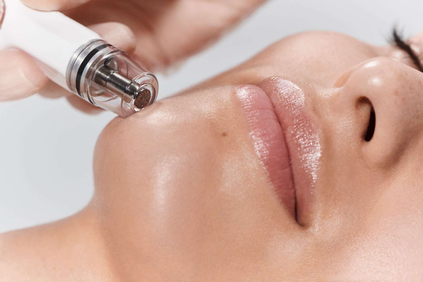 DiamondGlow facial in San Diego for medical grade skin resurfacing