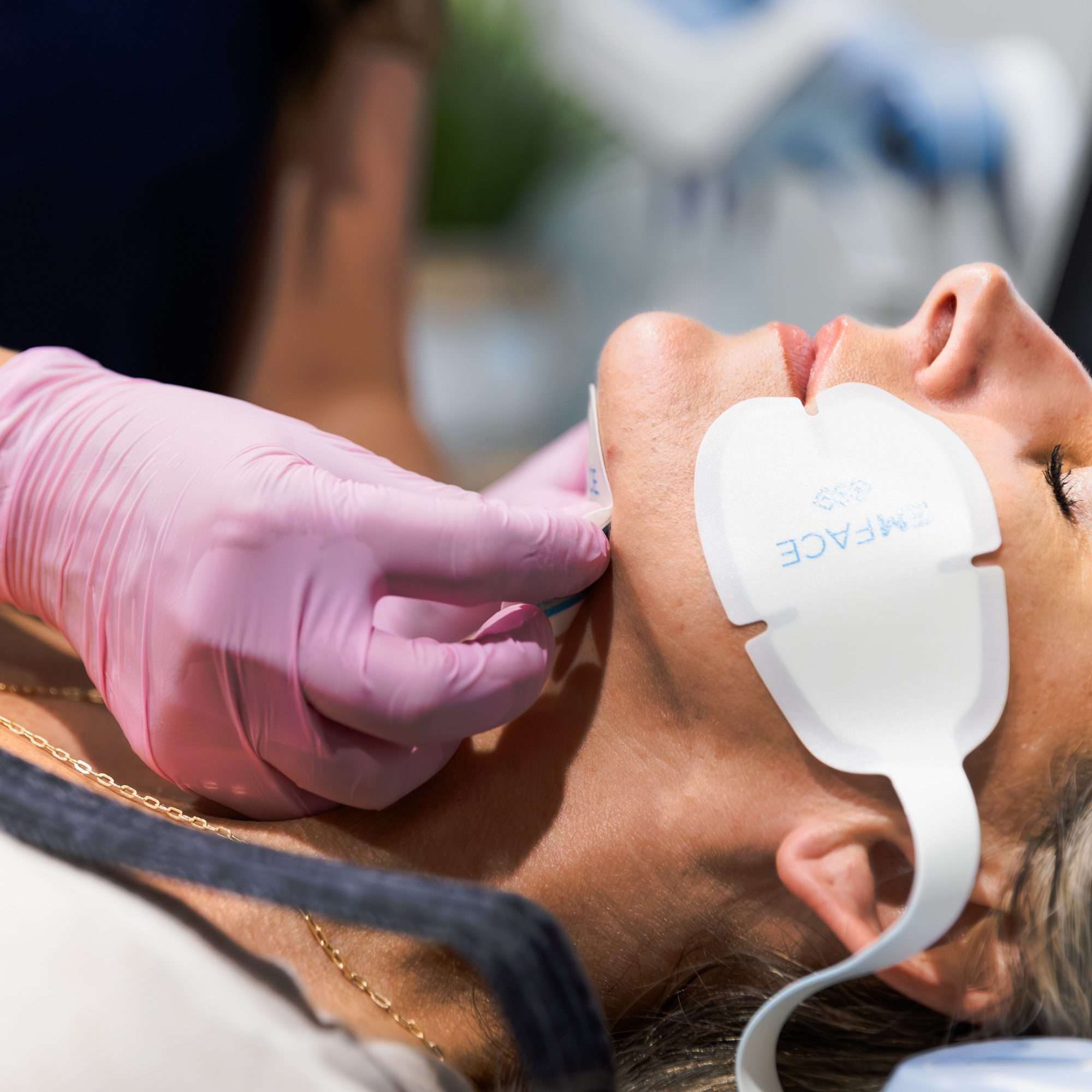 EMFACE facial lifting and toning treatment zero downtime San Diego med spa