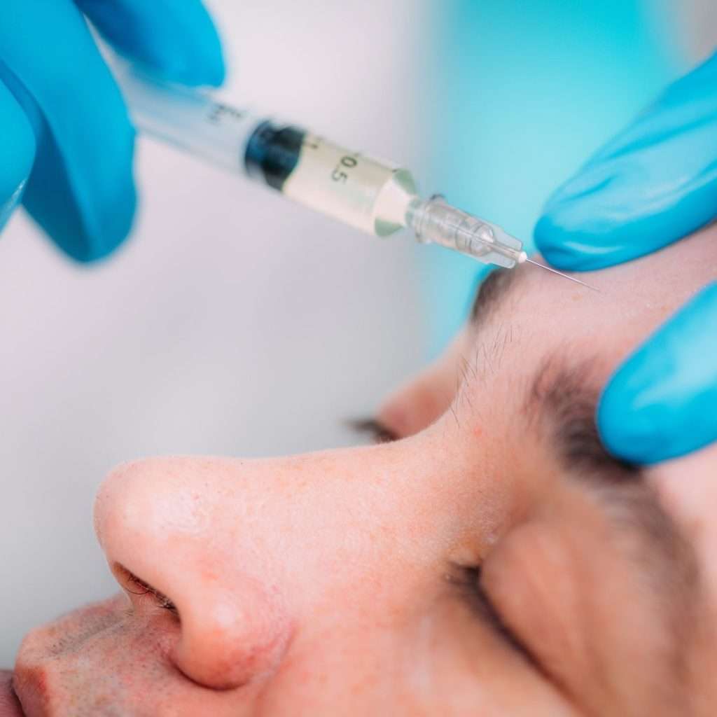 Botox for men before and after San Diego