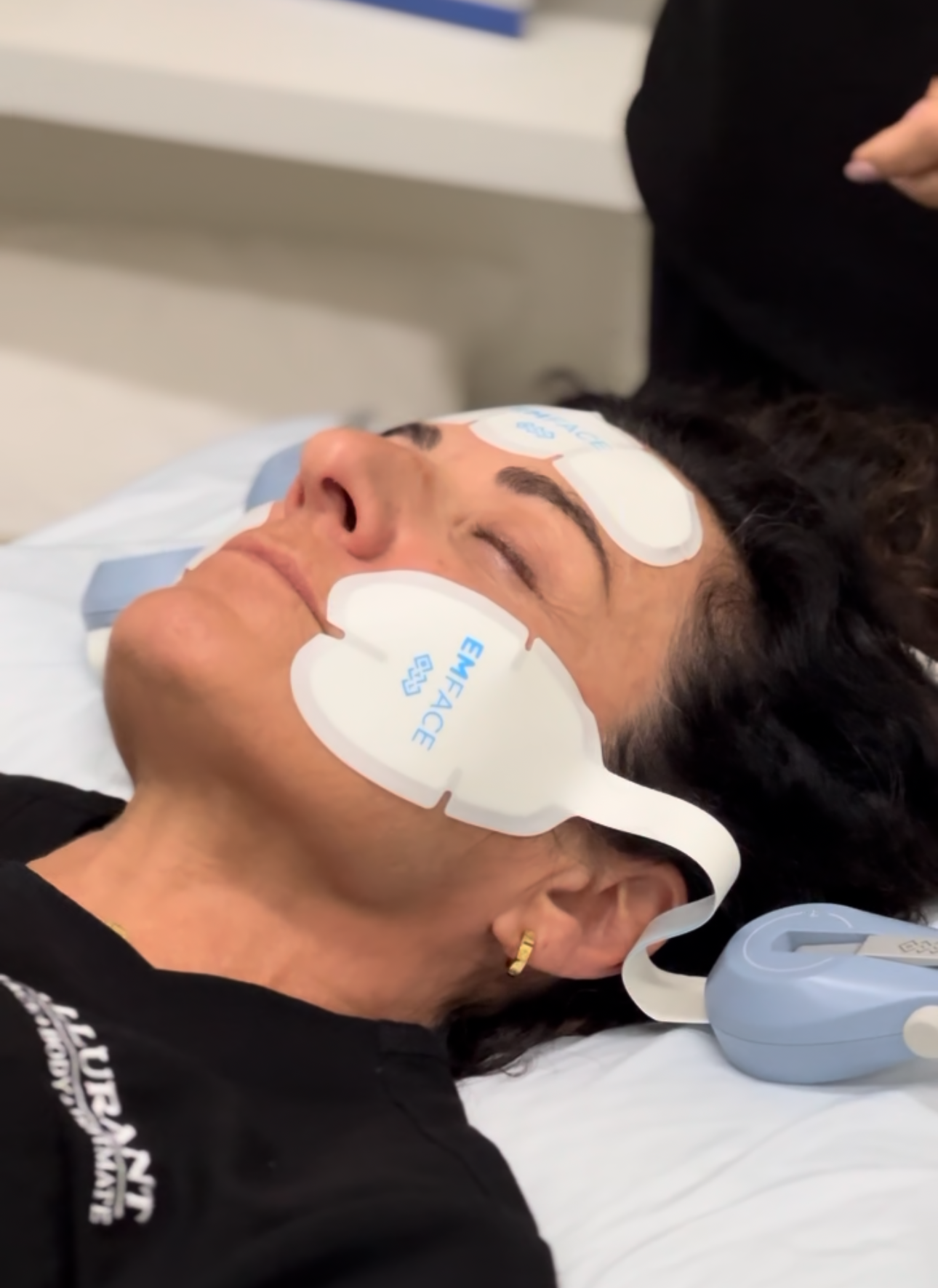 EMFACE non-surgical facial toning treatment in San Diego