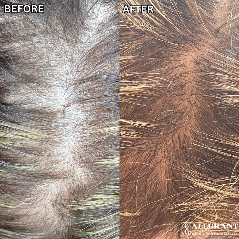 ALMA TED B&A