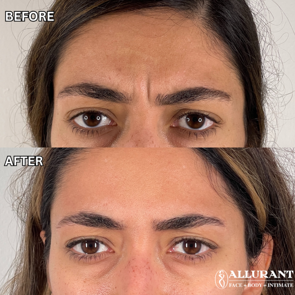 Before and Afters (small) (8)