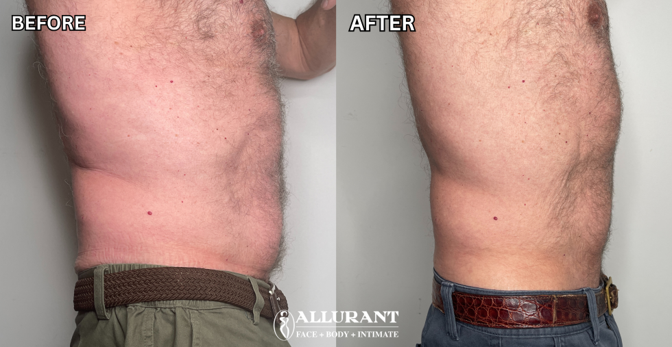 EVOLVE X B&A (DAN RIDDLE)