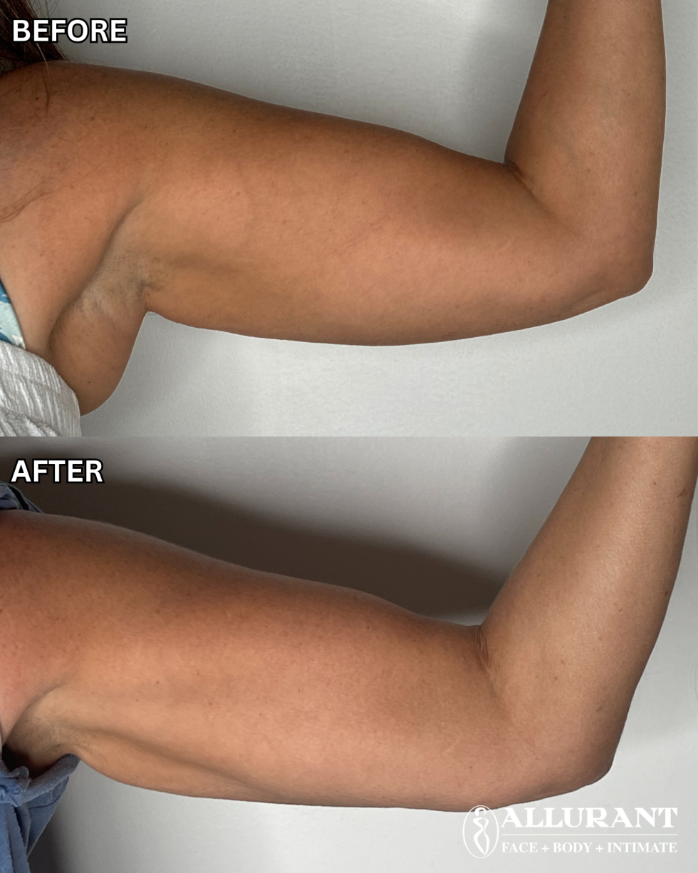 EVOLVE X B&A (debbie ellis)