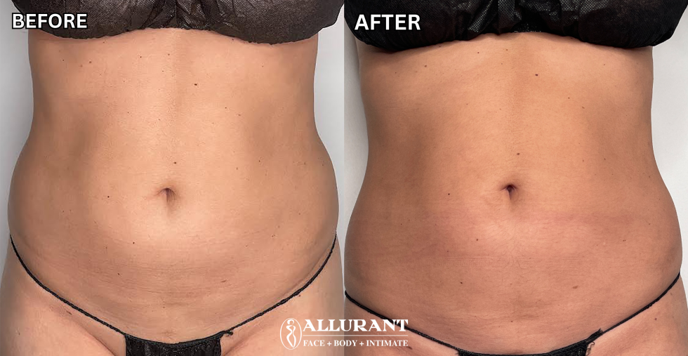 MEDICAL WEIGHT LOSS B&A 1 (erika sobelman)